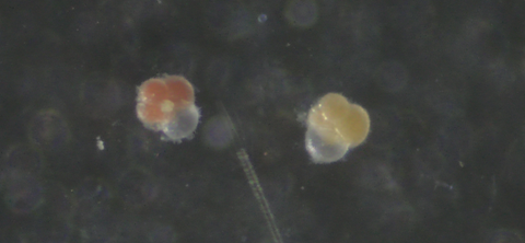 Mikroskopfotografi som visar N. pachyderma med gul och röd cytoplasma